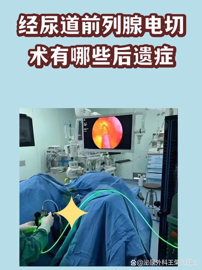 前列腺炎治疗