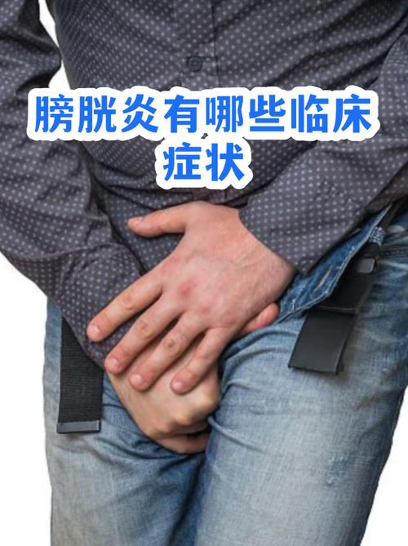 膀胱炎