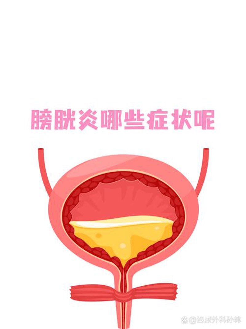 科学应对泌尿感染，守护健康生活